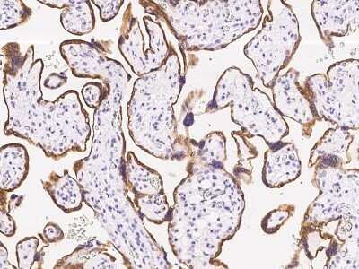 Immunohistochemistry: Aromatase Antibody [NBP2-99350]