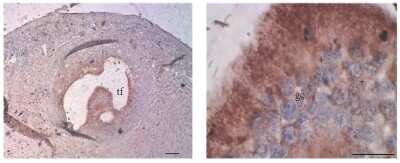 Immunohistochemistry-Paraffin: Aromatase Antibody [NB100-1596]