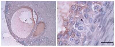 Immunohistochemistry-Paraffin: Aromatase Antibody [NB100-1596]