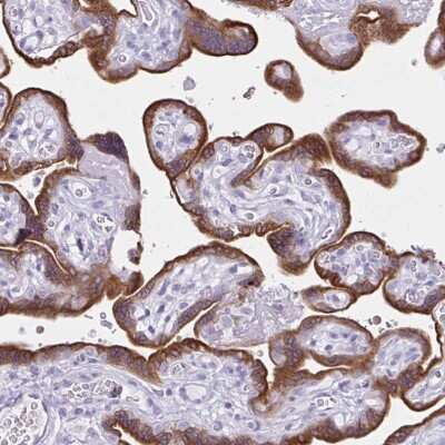 Immunohistochemistry-Paraffin: Aromatase Antibody [NBP2-48998]