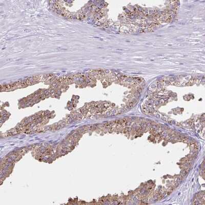 Immunohistochemistry-Paraffin: Aromatase Antibody [NBP2-48998]