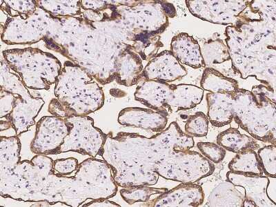 Immunohistochemistry-Paraffin: Aromatase Antibody [NBP2-97337]