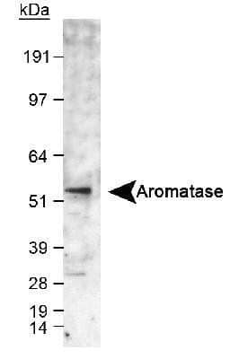 Western Blot: Aromatase Antibody [NB100-1596]