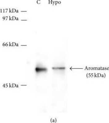 Western Blot: Aromatase Antibody [NB100-1596]