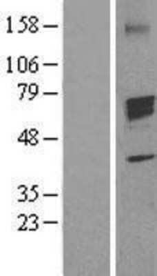 Western Blot: Aromatase Overexpression Lysate [NBL1-09674]