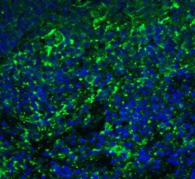 Immunocytochemistry/ Immunofluorescence: Arrestin 3 Antibody - BSA Free [NBP2-41249]