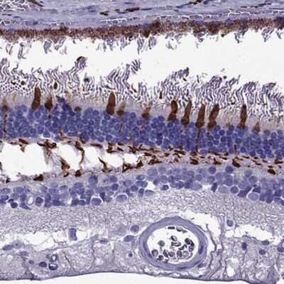 Immunohistochemistry-Paraffin: Arrestin 3 Antibody [NBP2-68802]