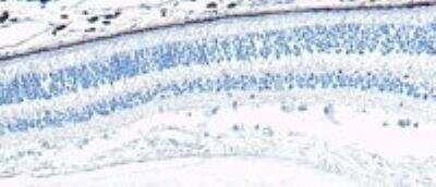 Immunohistochemistry-Paraffin: Arrestin 3 Antibody [NBP1-37003]