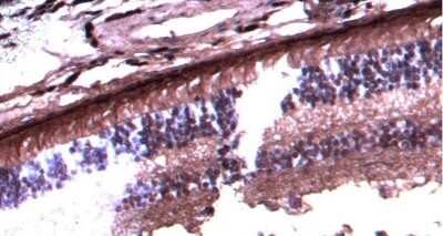 Immunohistochemistry-Paraffin: Arrestin 3 Antibody [NBP1-37003]