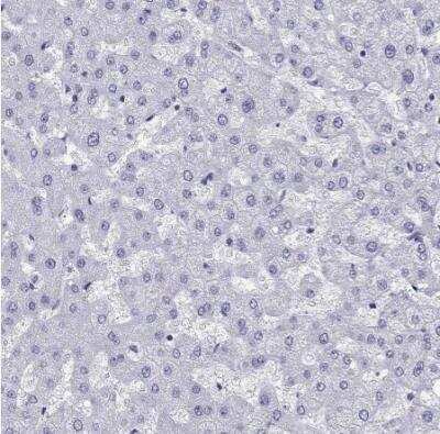 Immunohistochemistry-Paraffin: Arrestin 3 Antibody [NBP2-68802]