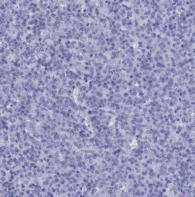 Immunohistochemistry-Paraffin: Arrestin 3 Antibody [NBP2-68802]