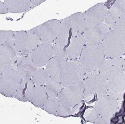 Immunohistochemistry-Paraffin: Arrestin 3 Antibody [NBP2-68802]