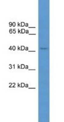 Western Blot: Arrestin 3 Antibody [NBP1-69084]