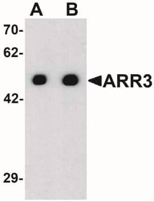 Western Blot: Arrestin 3 AntibodyBSA Free [NBP2-41249]