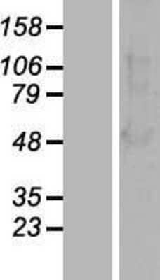 Western Blot: beta-Arrestin 1 Overexpression Lysate [NBL1-07732]