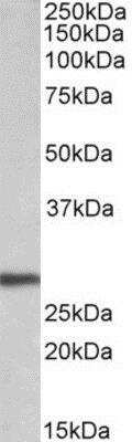 Western Blot: Artemin Antibody [NBP1-68857]