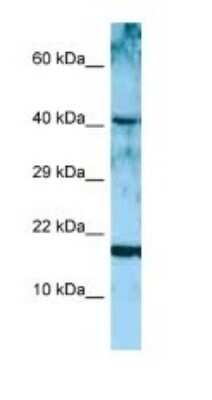 Western Blot: Artemin Antibody [NBP1-98555]