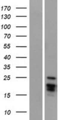 Western Blot: Artemin Overexpression Lysate [NBP2-05812]