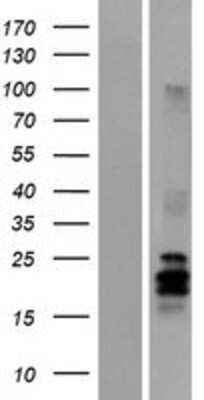 Western Blot: Artemin Overexpression Lysate [NBP2-05813]