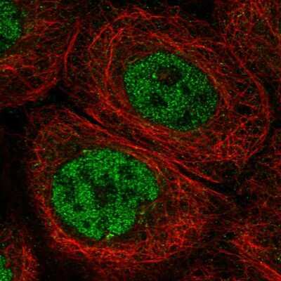 Immunocytochemistry/ Immunofluorescence: Artemis Antibody [NBP2-56362]