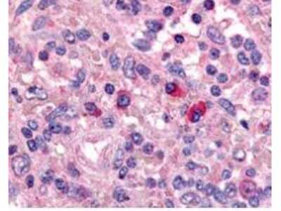 Immunohistochemistry: Artemis Antibody [NBP1-77975]