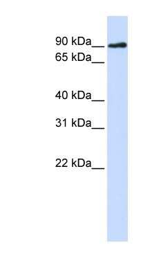 Western Blot: Artemis Antibody [NBP1-54356]