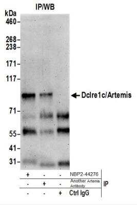 Western Blot: Artemis Antibody [NBP2-44276]