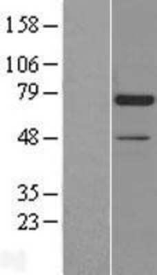 Western Blot: Artemis Overexpression Lysate [NBL1-09743]