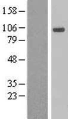 Western Blot: AHR Overexpression Lysate [NBL1-07403]