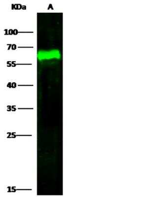 Western Blot: Arylsulfatase A/ARSA Antibody (001) [NBP2-89502]