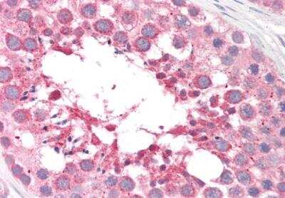 Immunohistochemistry-Paraffin: Arylsulfatase A/ARSA Antibody [NBP1-00154]