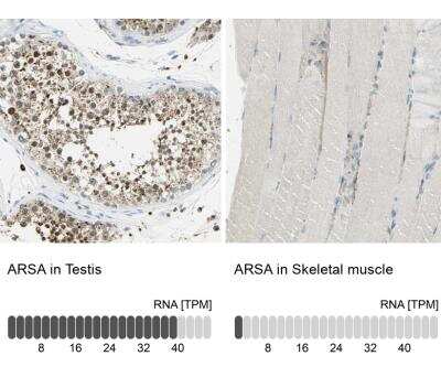 Immunohistochemistry-Paraffin: Arylsulfatase A/ARSA Antibody [NBP1-86135]