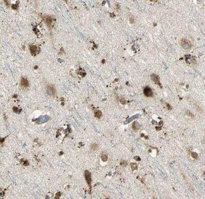 Immunohistochemistry-Paraffin: Arylsulfatase A/ARSA Antibody [NBP1-86135]