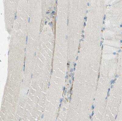 Immunohistochemistry-Paraffin: Arylsulfatase A/ARSA Antibody [NBP1-86135]