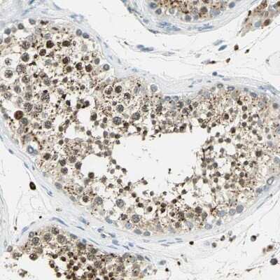 Immunohistochemistry-Paraffin: Arylsulfatase A/ARSA Antibody [NBP1-86135]
