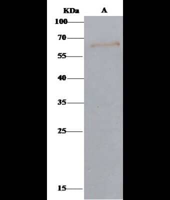 Immunoprecipitation: Arylsulfatase A/ARSA Antibody [NBP2-98210]