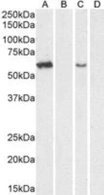 Western Blot: Arylsulfatase A/ARSA Antibody [NBP1-00154]