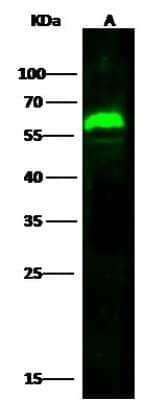 Western Blot: Arylsulfatase A/ARSA Antibody [NBP2-99307]