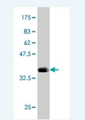 Western Blot: Arylsulfatase B/ARSB Antibody (1A4) [H00000411-M02]