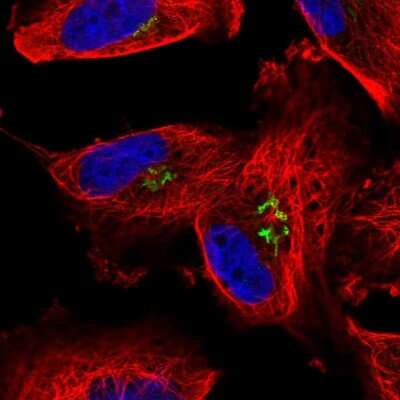 Immunocytochemistry/ Immunofluorescence: Arylsulfatase B/ARSB Antibody [NBP1-86270]