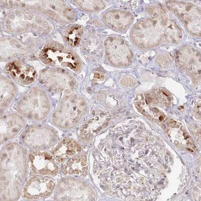 Immunohistochemistry-Paraffin: Arylsulfatase B/ARSB Antibody [NBP1-85879]