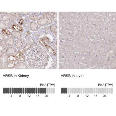 Immunohistochemistry-Paraffin: Arylsulfatase B/ARSB Antibody [NBP1-85879]