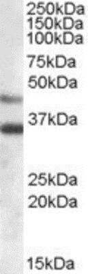 Western Blot: Arylsulfatase B/ARSB Antibody [NBP1-06021]