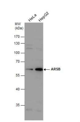 Western Blot: Arylsulfatase B/ARSB Antibody [NBP2-15474]