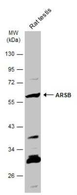 Western Blot: Arylsulfatase B/ARSB Antibody [NBP2-15474]