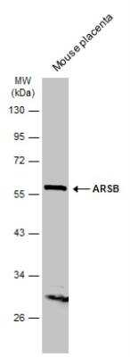 Western Blot: Arylsulfatase B/ARSB Antibody [NBP2-15474]