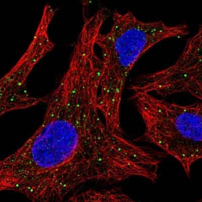 Immunocytochemistry/ Immunofluorescence: Arylsulfatase D Antibody [NBP2-56968]