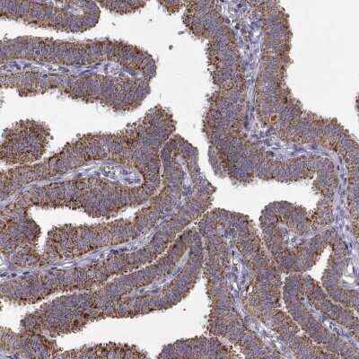 Immunohistochemistry-Paraffin: Arylsulfatase D Antibody [NBP1-87486]