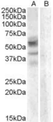 Western Blot: Arylsulfatase D Antibody [NBP1-20886]