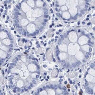 Immunohistochemistry-Paraffin: Arylsulfatase G/ARSG Antibody [NBP1-82947]